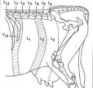 Figure 17 : Régions du flanc anesthésiées après une anesthésie paravertébrale proximale ou distale